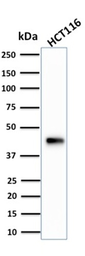 Anti-Cytokeratin 18 antibody [KRT18/834] used in Western Blot (WB). GTX34642