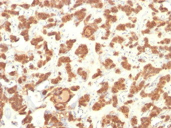Anti-Cytokeratin 18 antibody [Cocktail] used in IHC (Paraffin sections) (IHC-P). GTX34645