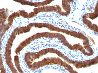 Anti-Cytokeratin 19 antibody [Ks19.1] used in IHC (Paraffin sections) (IHC-P). GTX34652