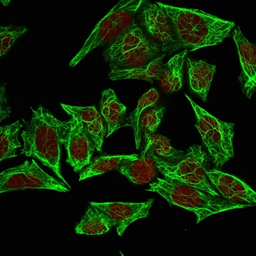 Anti-Cytokeratin 7 antibody [SPM270] used in Immunocytochemistry/ Immunofluorescence (ICC/IF). GTX34656