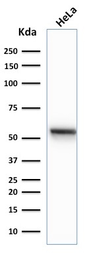 Anti-Cytokeratin 7 antibody [K72.7] used in Western Blot (WB). GTX34657