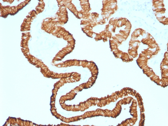 Anti-Cytokeratin 7 antibody [KRT7/1499R] used in IHC (Paraffin sections) (IHC-P). GTX34661