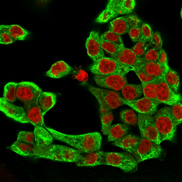 Anti-Cytokeratin 8 antibody [H1] used in Immunocytochemistry/ Immunofluorescence (ICC/IF). GTX34663