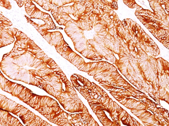 Anti-Cytokeratin 8 antibody [H1] used in IHC (Paraffin sections) (IHC-P). GTX34663