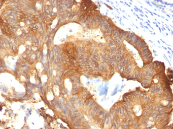 Anti-Cytokeratin 8 antibody [B22.1] used in IHC (Paraffin sections) (IHC-P). GTX34664