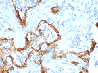 Anti-Cytokeratin 8 antibody [SPM192] used in IHC (Paraffin sections) (IHC-P). GTX34668