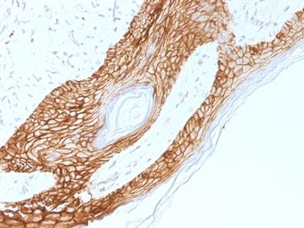 Anti-E-Cadherin antibody [4A2] used in IHC (Paraffin sections) (IHC-P). GTX34679