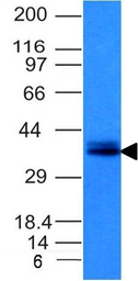 Anti-EpCAM antibody [EGP40/1120] used in Western Blot (WB). GTX34692