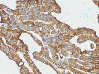 Anti-EpCAM antibody [EGP40/1372] used in IHC (Paraffin sections) (IHC-P). GTX34694
