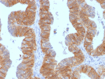 Anti-EpCAM antibody [EGP40/1384] used in IHC (Paraffin sections) (IHC-P). GTX34696
