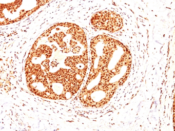 Anti-Estrogen Receptor beta antibody [ESR2/686] used in IHC (Paraffin sections) (IHC-P). GTX34712