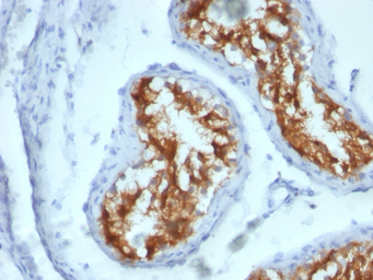 Anti-Fascin 1 antibody [FSCN1/417] used in IHC (Paraffin sections) (IHC-P). GTX34718