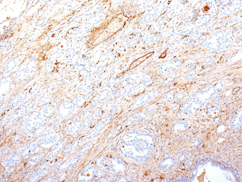 Anti-Fibronectin antibody [SPM246] used in IHC (Paraffin sections) (IHC-P). GTX34728