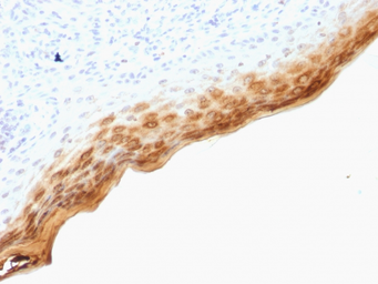 Anti-Filaggrin antibody [SPM181] used in IHC (Paraffin sections) (IHC-P). GTX34732