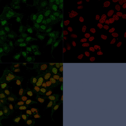 Anti-FOXA1 antibody [FOXA1/1241] used in Immunocytochemistry/ Immunofluorescence (ICC/IF). GTX34735