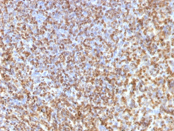 Anti-Galectin 13 antibody [PP13/1161] used in IHC (Paraffin sections) (IHC-P). GTX34747