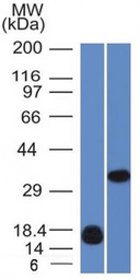 Anti-Galectin 13 antibody [PP13/1161] used in Western Blot (WB). GTX34747