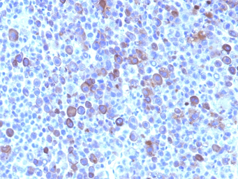 Anti-Glypican-3 antibody [SPM595] used in IHC (Paraffin sections) (IHC-P). GTX34762