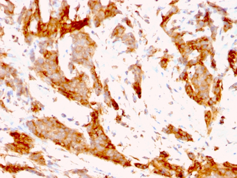 Anti-GRP94 antibody [9G10.F8.2] used in IHC (Paraffin sections) (IHC-P). GTX34771