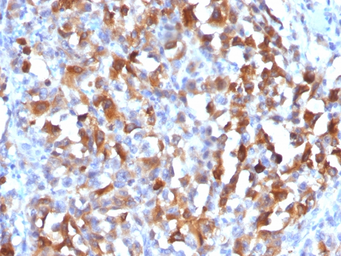 Anti-Melan A antibody used in IHC (Paraffin sections) (IHC-P). GTX34822