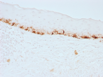 Anti-Melan A antibody [M2-7C10] used in IHC (Paraffin sections) (IHC-P). GTX34823