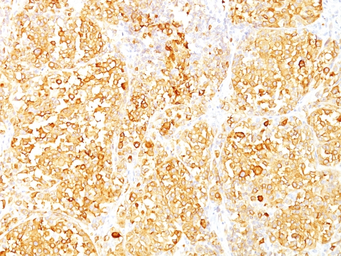 Anti-Melan A antibody [M2-9E3] used in IHC (Paraffin sections) (IHC-P). GTX34826