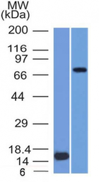 Anti-MMP2 antibody [MMP2/1501] used in Western Blot (WB). GTX34845