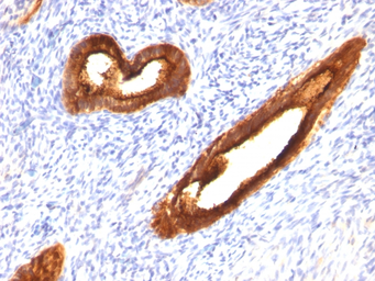 Anti-MUC1 antibody [MUC1/520] used in IHC (Paraffin sections) (IHC-P). GTX34855