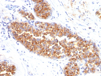 Anti-MUC1 antibody [MUC1/845] used in IHC (Paraffin sections) (IHC-P). GTX34859