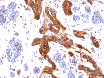 Anti-MUC1 antibody [MUC1/845] used in IHC (Paraffin sections) (IHC-P). GTX34859
