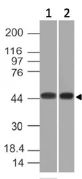 Anti-Napsin A antibody [NAPSA/1239] used in Western Blot (WB). GTX34888