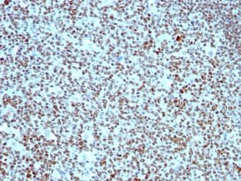 Anti-Nucleolin antibody [SPM614] used in IHC (Paraffin sections) (IHC-P). GTX34915