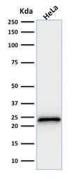 Anti-p21 Cip1 antibody [SPM306] used in Western Blot (WB). GTX34923