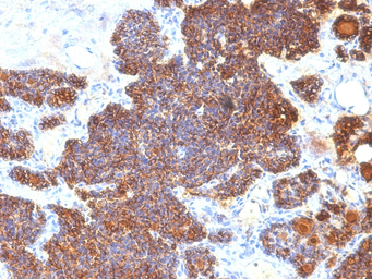 Anti-Parathyroid Hormone antibody [PTH/1174] used in IHC (Paraffin sections) (IHC-P). GTX34952