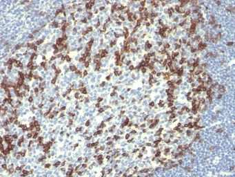 Anti-PD1 antibody [PDCD1/922] used in IHC (Paraffin sections) (IHC-P). GTX34966