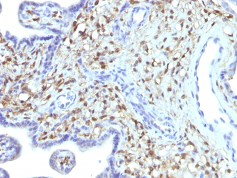 Anti-S100A4 antibody [S100A4/1481] used in IHC (Paraffin sections) (IHC-P). GTX34999