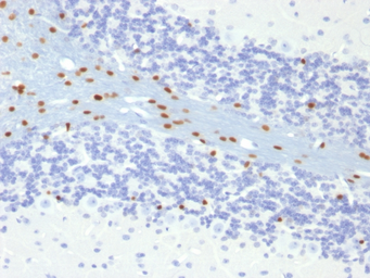 Anti-SOX10 antibody [SOX10/991] used in IHC (Paraffin sections) (IHC-P). GTX35083