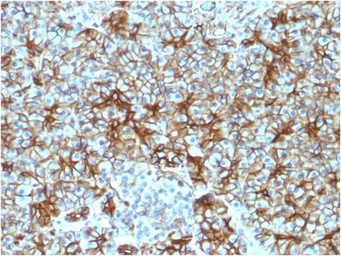 Anti-SPTBN2 antibody [SPTBN2/1583] used in IHC (Paraffin sections) (IHC-P). GTX35090