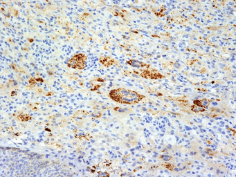 Anti-TNF alpha antibody [TNFA/1172] used in IHC (Paraffin sections) (IHC-P). GTX35131