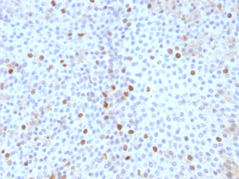 Anti-Topoisomerase II alpha antibody [TOP2A/1361] used in IHC (Paraffin sections) (IHC-P). GTX35137