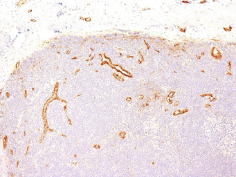 Anti-VWF antibody [IIIE2.34] used in IHC (Paraffin sections) (IHC-P). GTX35168