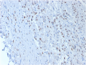 Anti-Wilms Tumor 1 antibody [SPM361] used in IHC (Paraffin sections) (IHC-P). GTX35173
