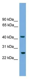 Anti-RAB35 antibody used in Western Blot (WB). GTX35180