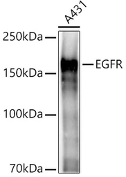 Anti-EGFR antibody used in Western Blot (WB). GTX35199