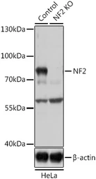 Anti-Merlin antibody used in Western Blot (WB). GTX35202