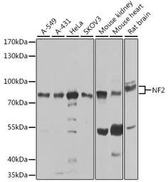 Anti-Merlin antibody used in Western Blot (WB). GTX35202