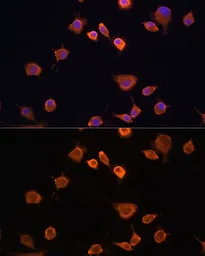 Anti-Merlin antibody used in Immunocytochemistry/ Immunofluorescence (ICC/IF). GTX35202