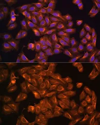 Anti-Merlin antibody used in Immunocytochemistry/ Immunofluorescence (ICC/IF). GTX35202
