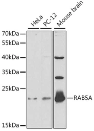 Anti-RAB5A antibody used in Western Blot (WB). GTX35207