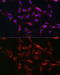 Anti-RAB5A antibody used in Immunocytochemistry/ Immunofluorescence (ICC/IF). GTX35207